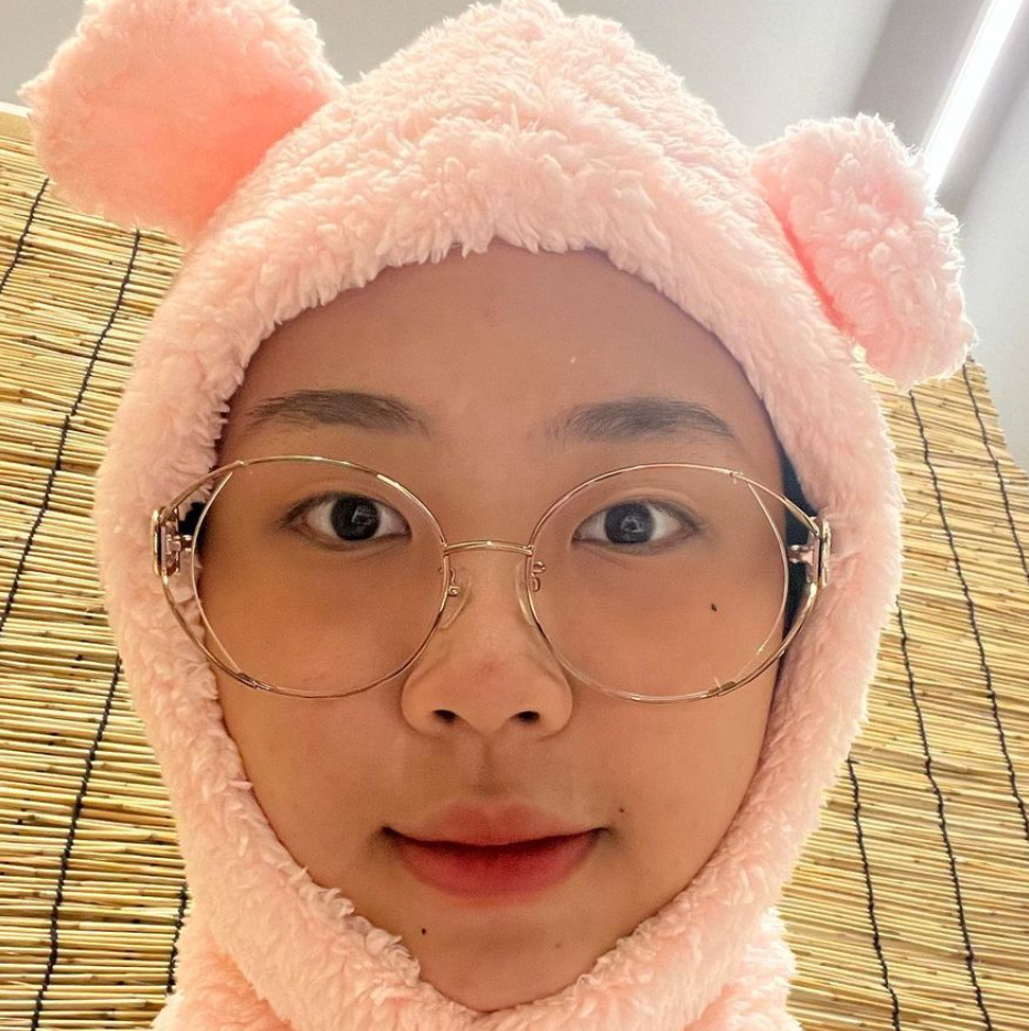 가수 이영지, '아이스버킷 챌린지'에 참여, 1000만원 기부로 루게릭병 환자 돕기 역시 MZ대통령 129 가수 이영지, ‘아이스버킷 챌린지’에 참여, 1000만원 기부로 루게릭병 환자 돕기 역시 MZ대통령